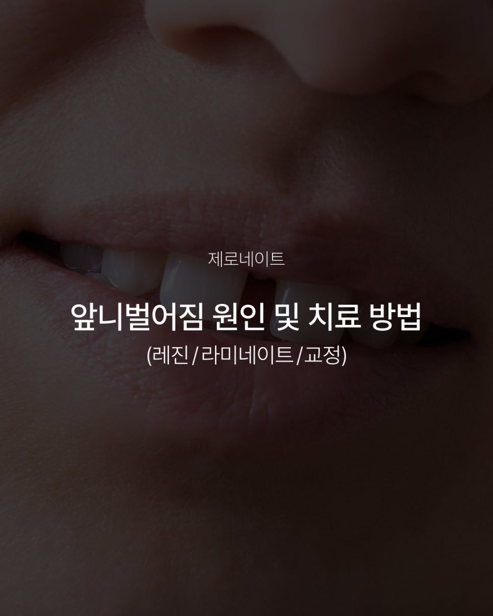 앞니벌어짐 원인부터 치료 방법 총정리 (레진, 라미네이트, 교정) 관련 이미지 1