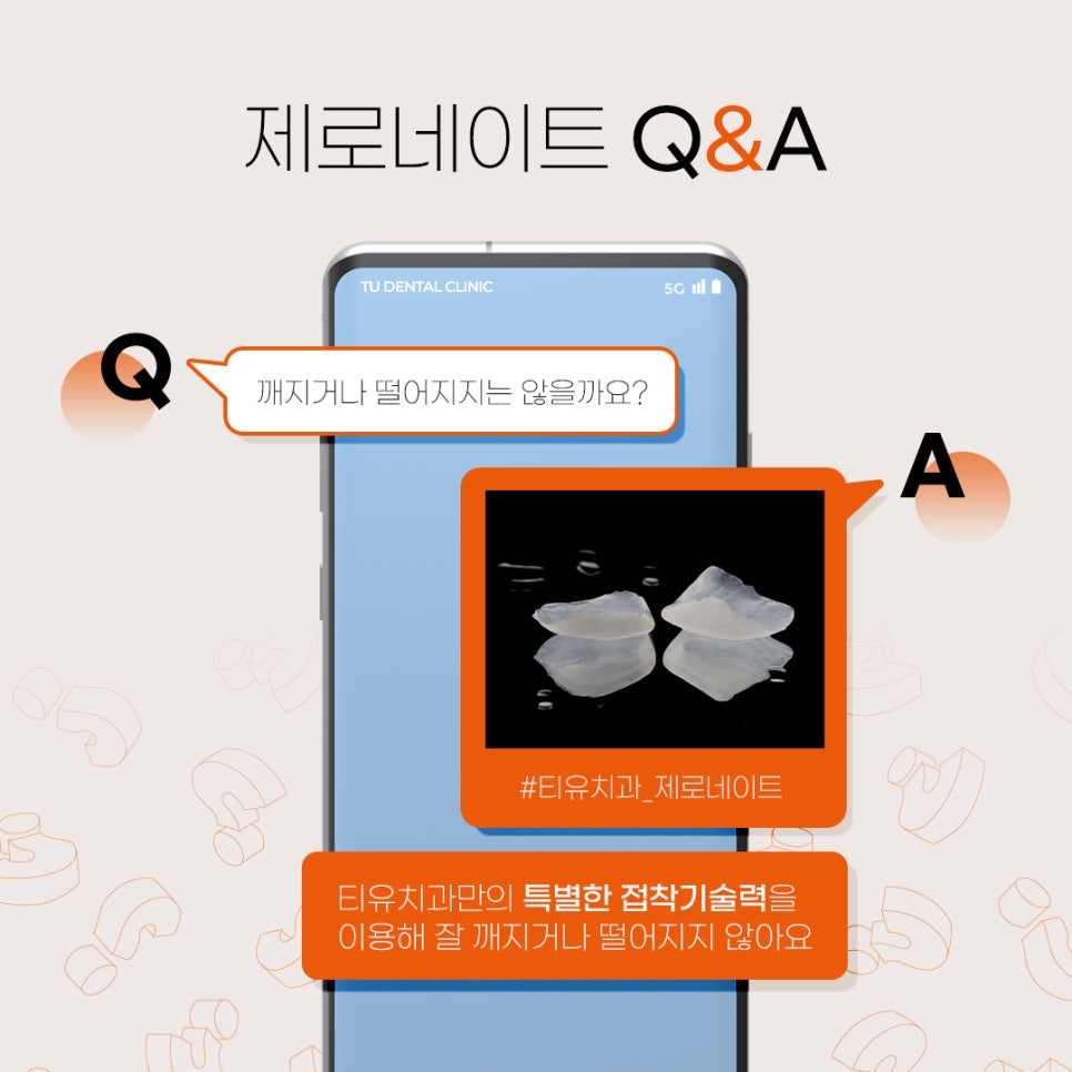 기존 자연치아를 보존하는 라미네이트 방법은? 관련 이미지 6