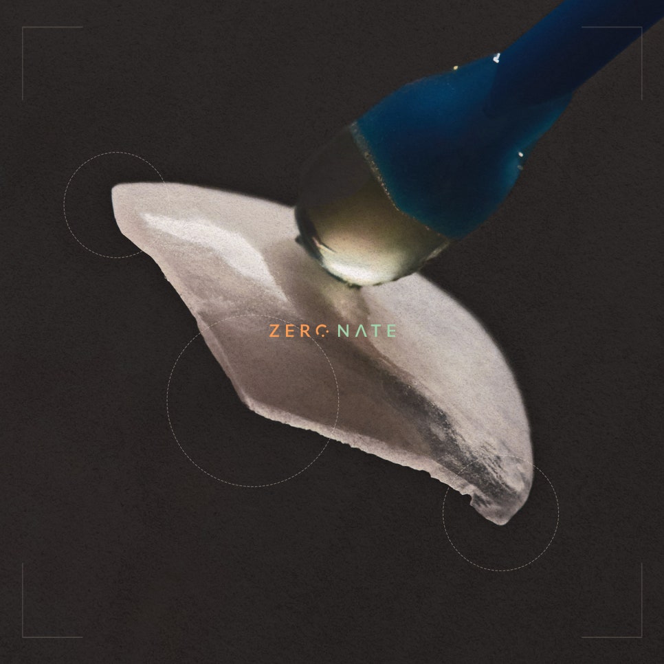 티유치과 8월 매거진, 대표원장님도 시술받은 제로네이트 [TU치과] 관련 이미지 2