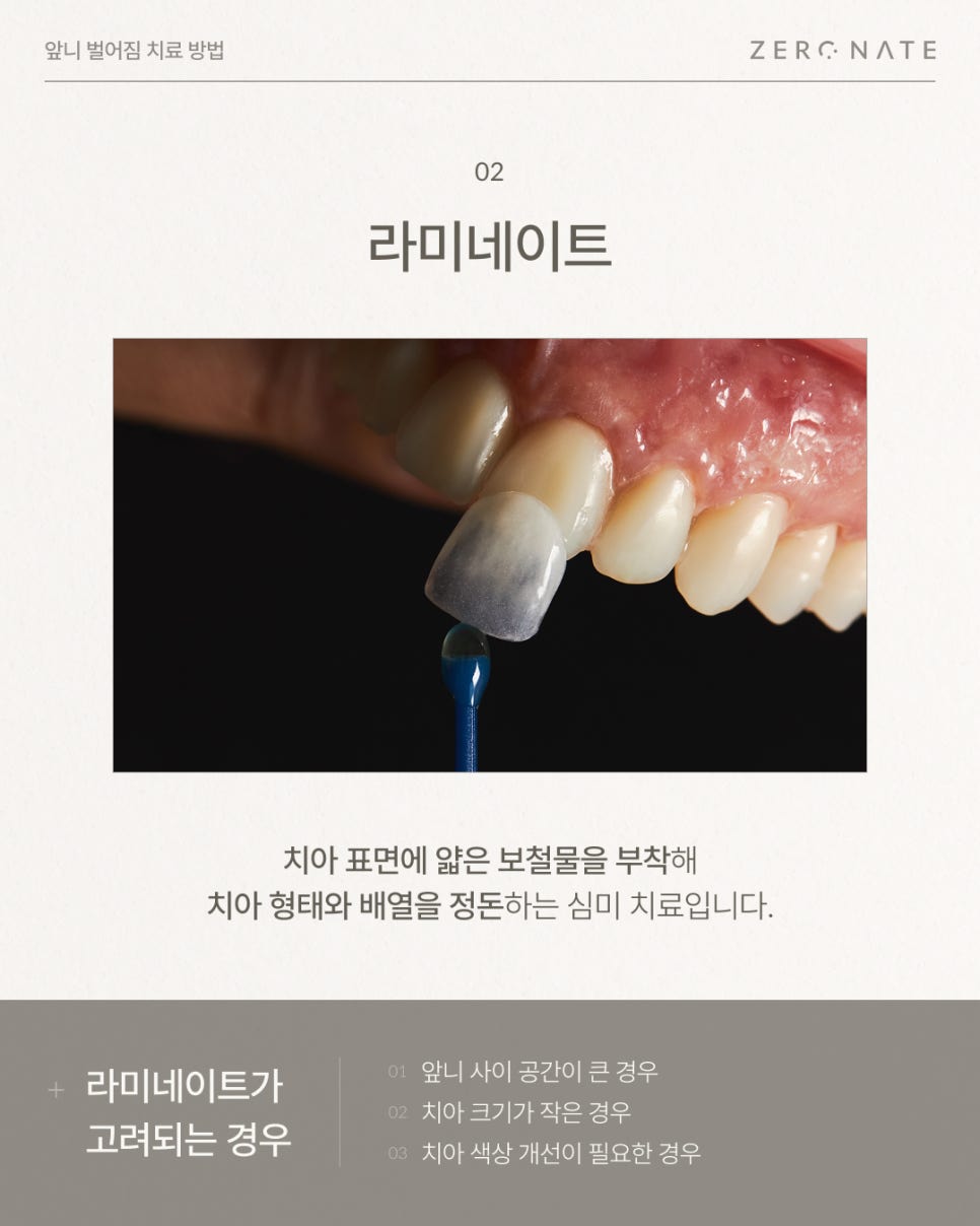 앞니벌어짐 원인부터 치료 방법 총정리 (레진, 라미네이트, 교정) 관련 이미지 7