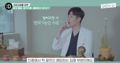 [TU치과/티유치과]치아교정하면 광대가 나온다구?? 팔자주름이 생기고 볼이 패인다구?? 관련 이미지 6