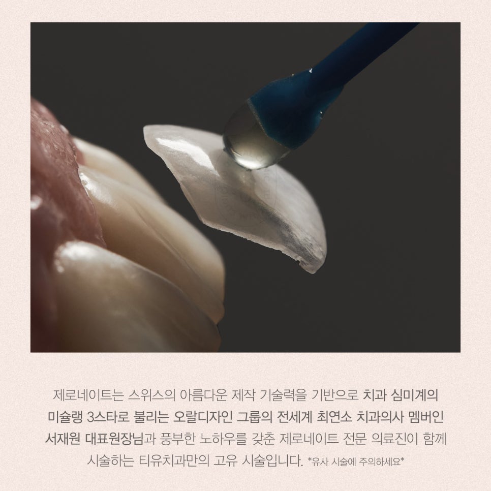 티유치과 7월 매거진, 치경부 마모증 치료법 [TU치과] 관련 이미지 9