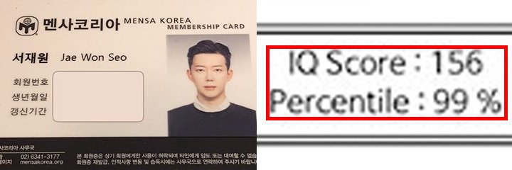 TU치과 서재원 원장님이 피클코에 떴어요!! 관련 이미지 4