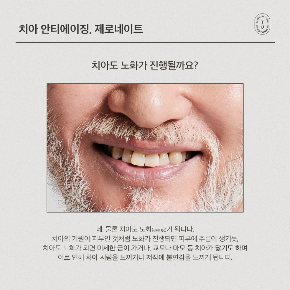 [티유치과] 안티에이징의 치료법, 제로네이트[TU치과] 관련 이미지 2