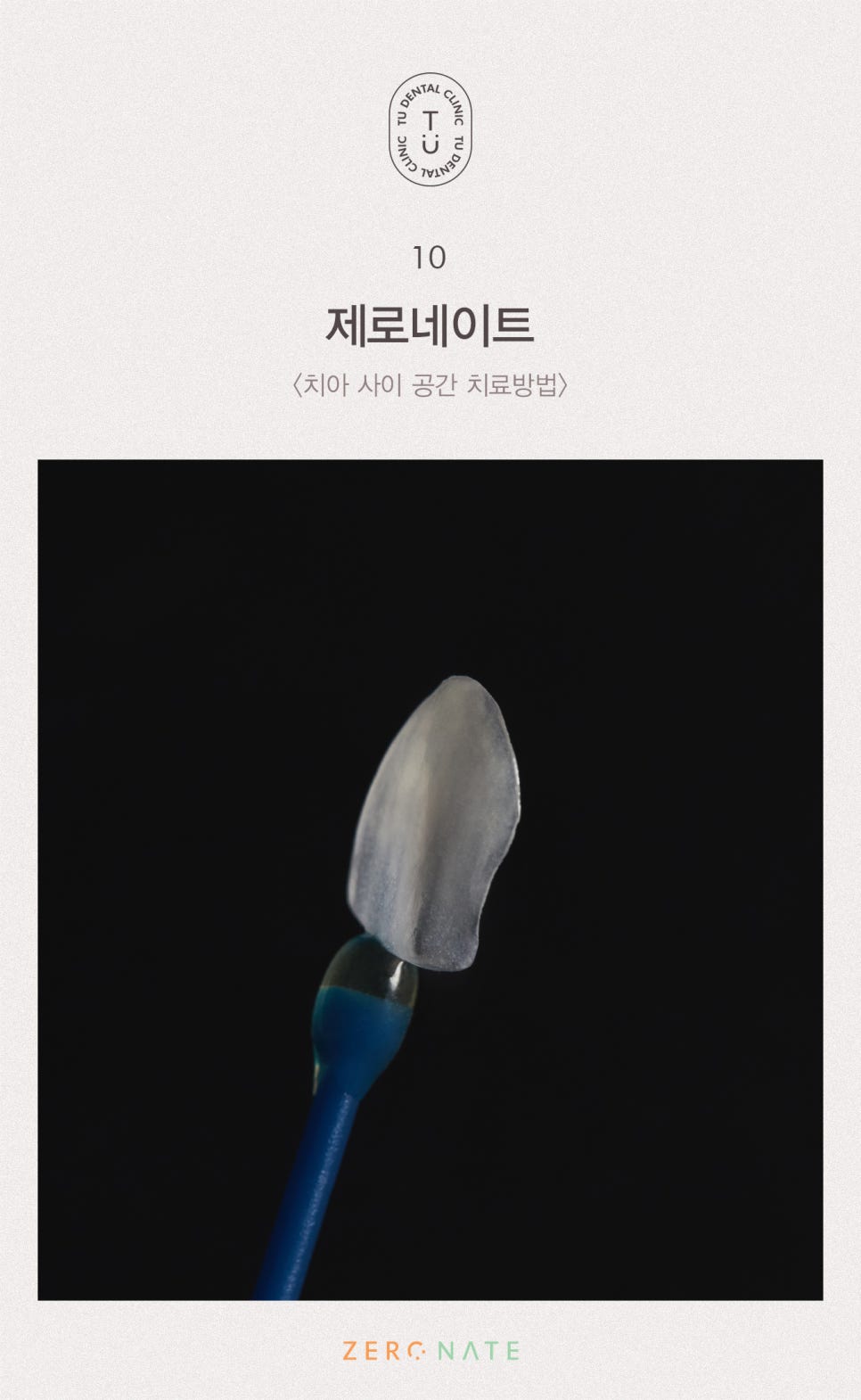 치아 사이 공간 치료방법, 티유치과[TU치과] 관련 이미지 11