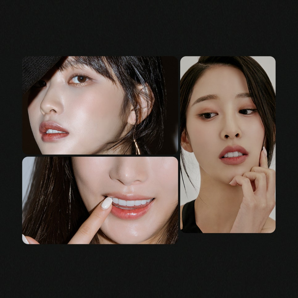 티유치과 4월 매거진, 블랙트라이앵글 치아의 치료법 [TU치과] 관련 이미지 6