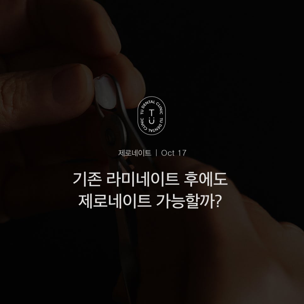 [티유치과] 기존 라미네이트를 제로네이트로 교체도 가능할까요?[TU치과] 관련 이미지 1