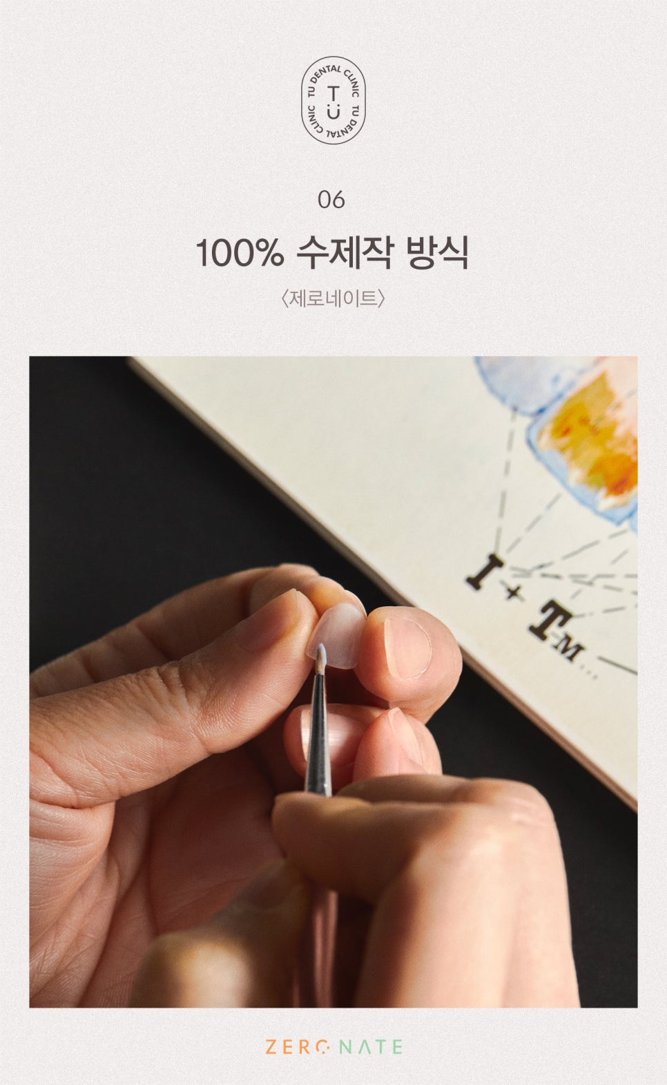 파절된 치아 치료방법, 티유치과[TU치과] 관련 이미지 7