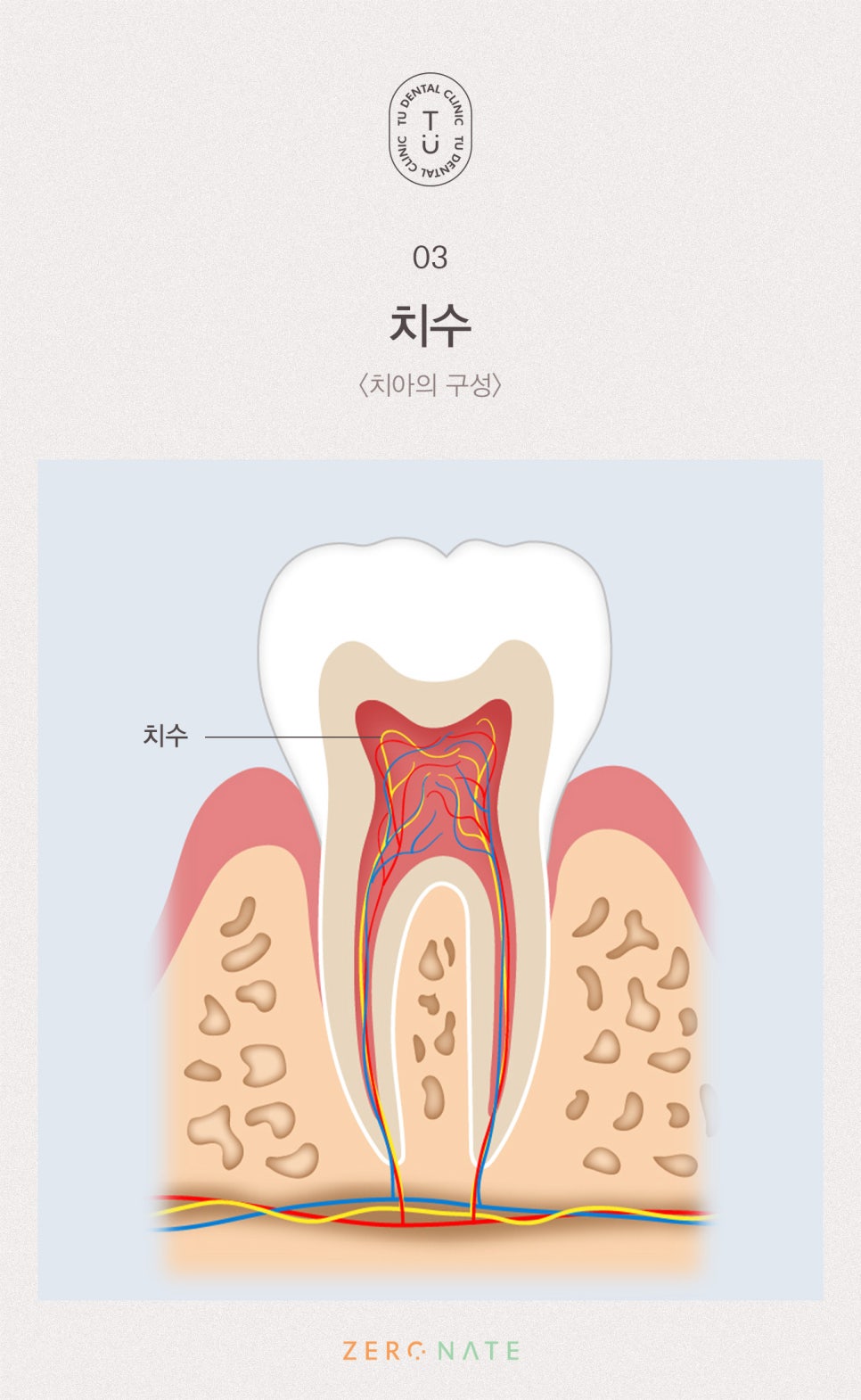 변색된 치아 치료방법, 티유치과 제로네이트 [TU치과] 관련 이미지 4