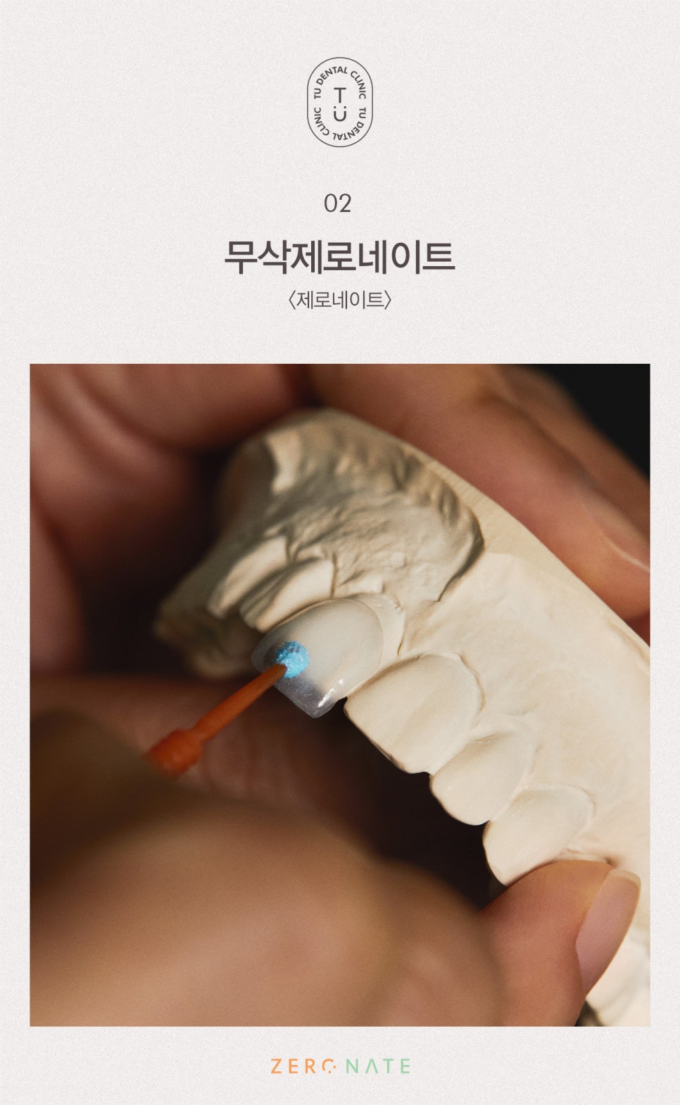 티유치과 제로네이트 관리법에 대해 알려드립니다 [TU치과] 관련 이미지 3