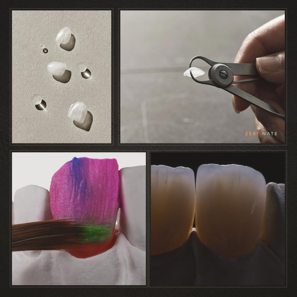 티유치과 8월 매거진, 대표원장님도 시술받은 제로네이트 [TU치과] 관련 이미지 5