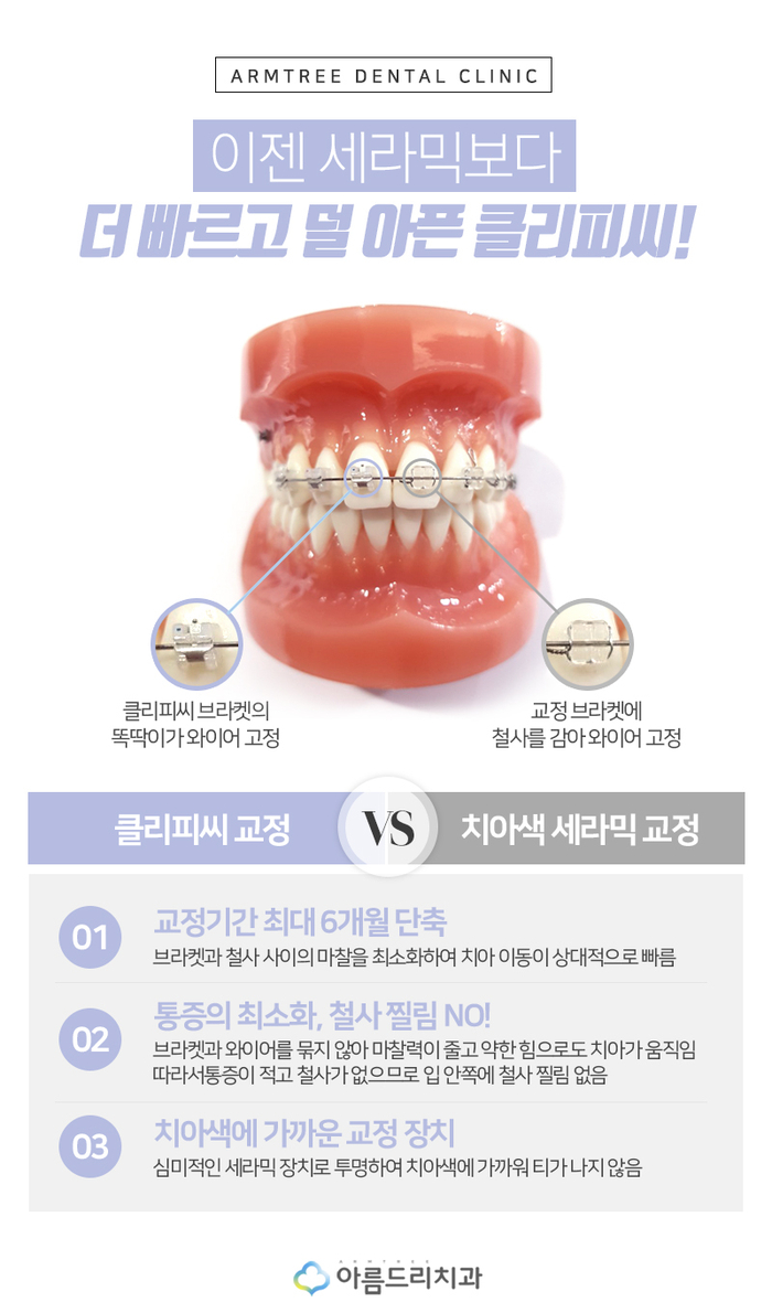 치아 부정교합교정 꼭 필요한 이유 관련 이미지 7