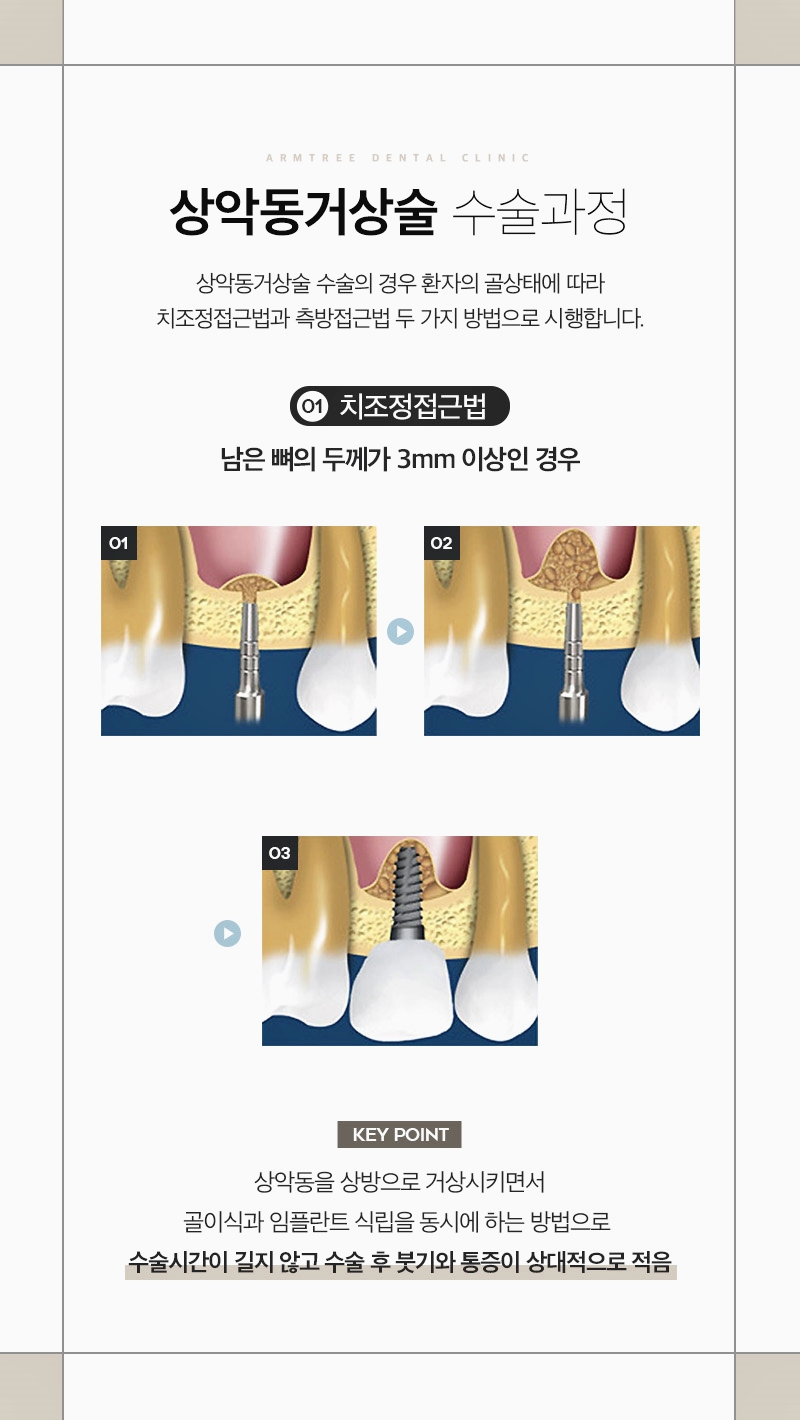 신논현역치과 상악동거상술과 임플란트는 아름드리치과에서 관련 이미지 4