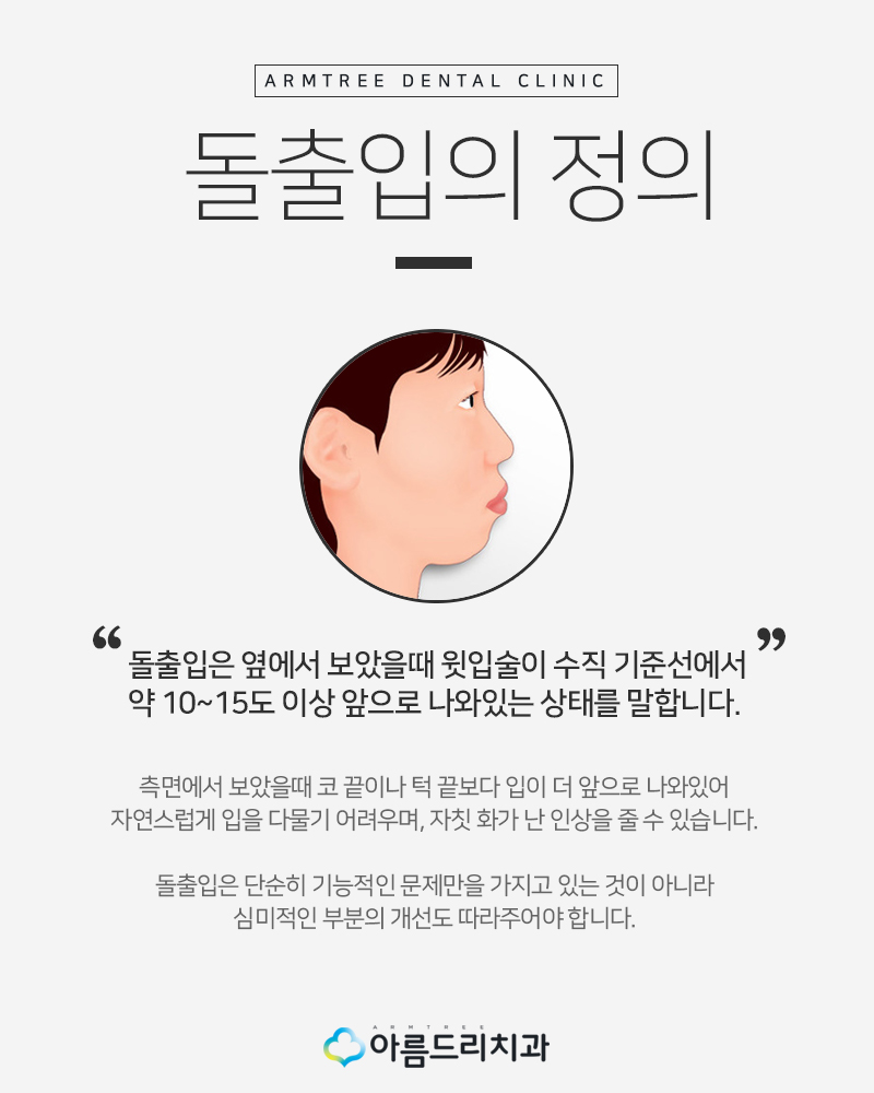입툭튀교정 돌출앞니 환자후기 관련 이미지 3