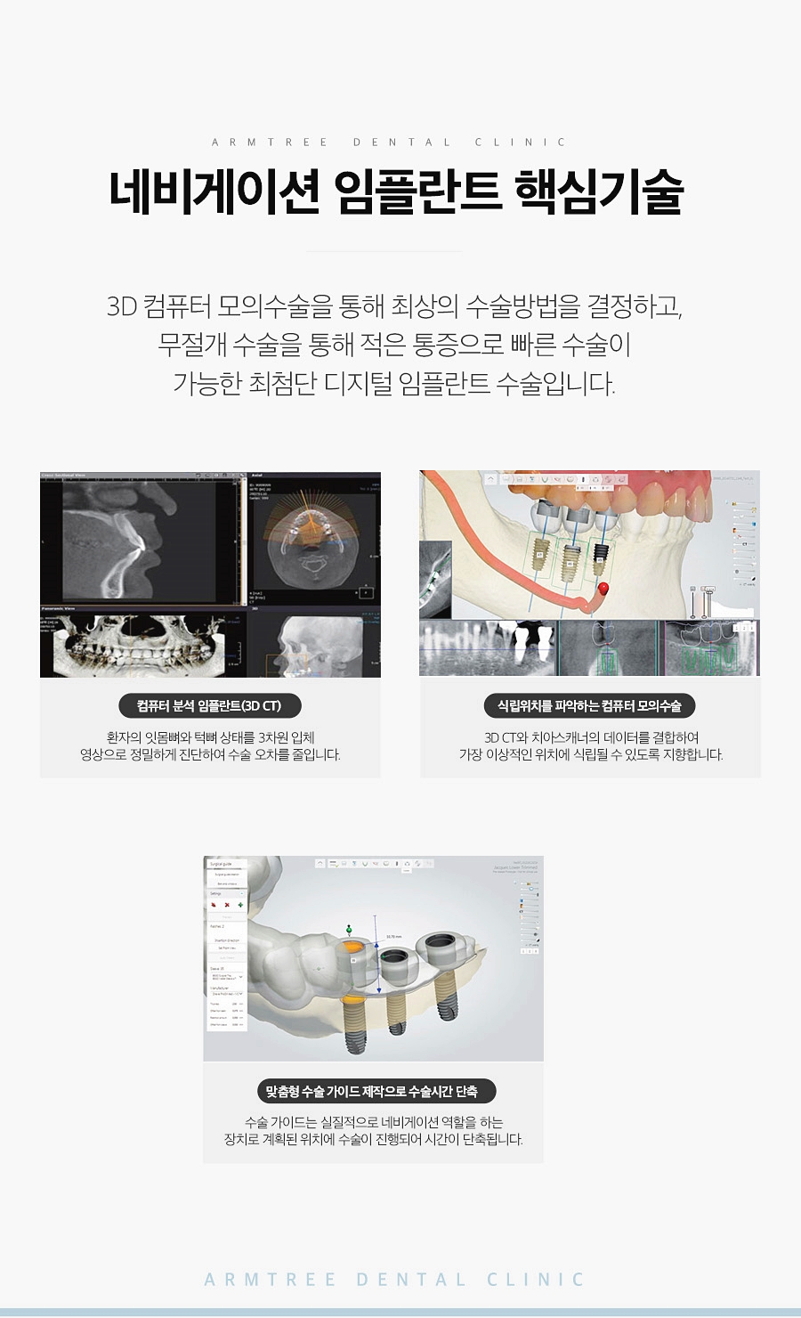 네비게이션임플란트가격 컴퓨터분석 신논현역치과 관련 이미지 5