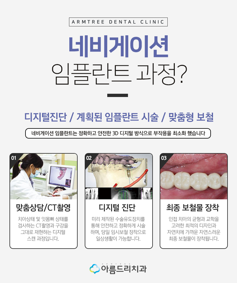 인플란트통증 걱정없는 디지털임플란트 관련 이미지 5