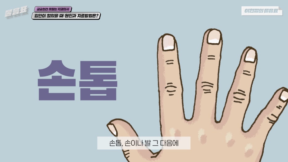 입안이 헐었을때 해결방법 이현정의물음표 관련 이미지 6