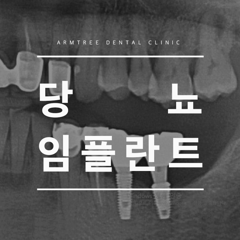 당뇨임플란트 신논현역 아름드리치과라면 관련 이미지 1