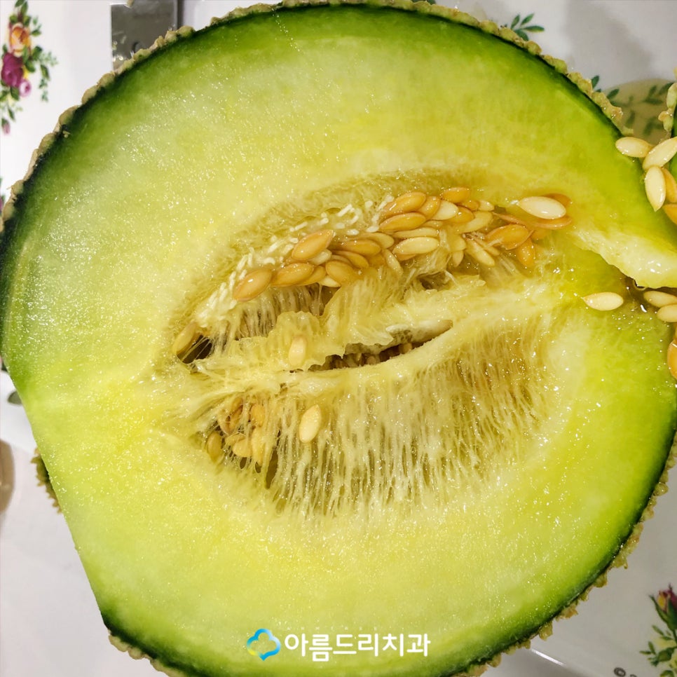 디지털임플란트 환자의 감사선물 관련 이미지 8