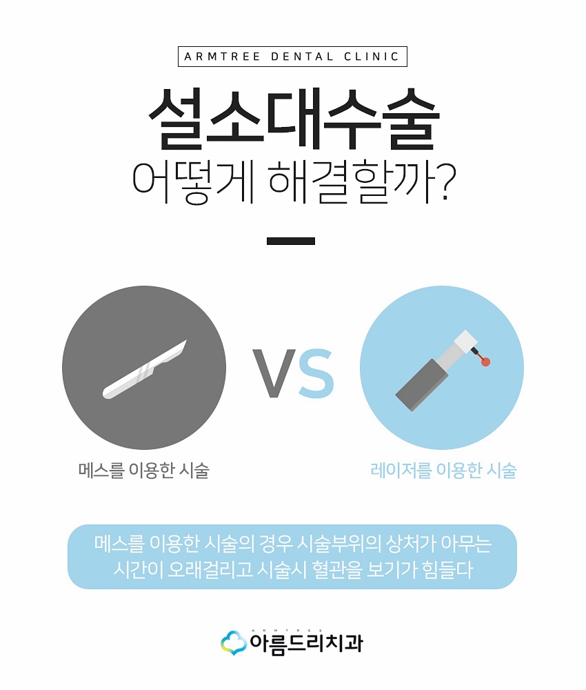 성인설소대수술후기 설소대단축증 아름드리치과 관련 이미지 5