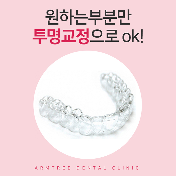 윗니교정 비용 알아볼까? 관련 이미지 2