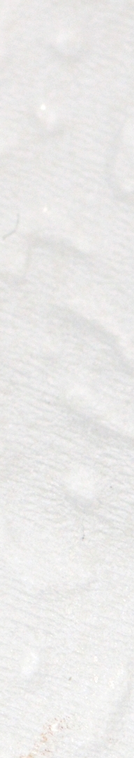 신논현치과 사랑니발치 치과는 신중하게 관련 이미지 13