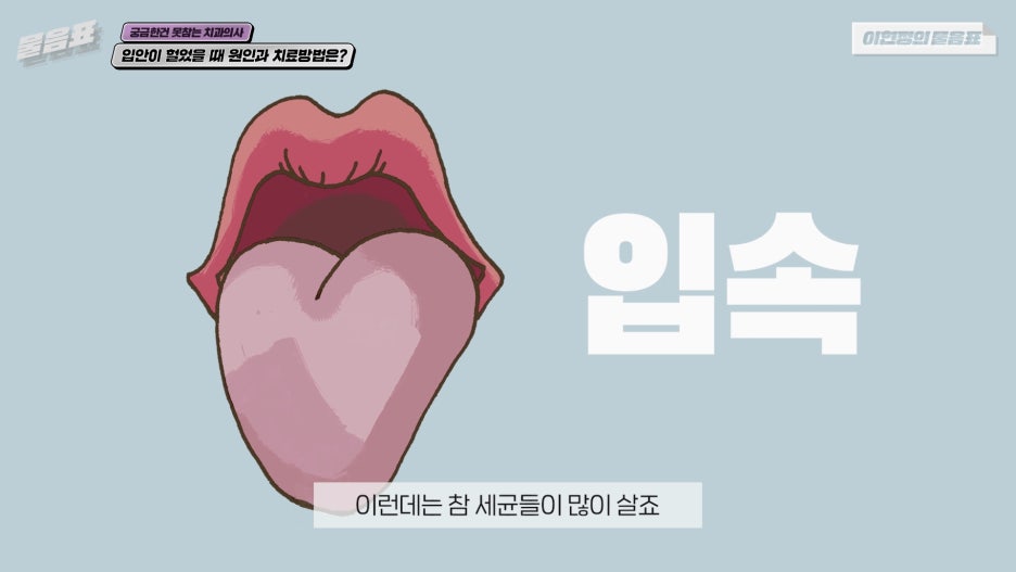 입안이 헐었을때 해결방법 이현정의물음표 관련 이미지 10