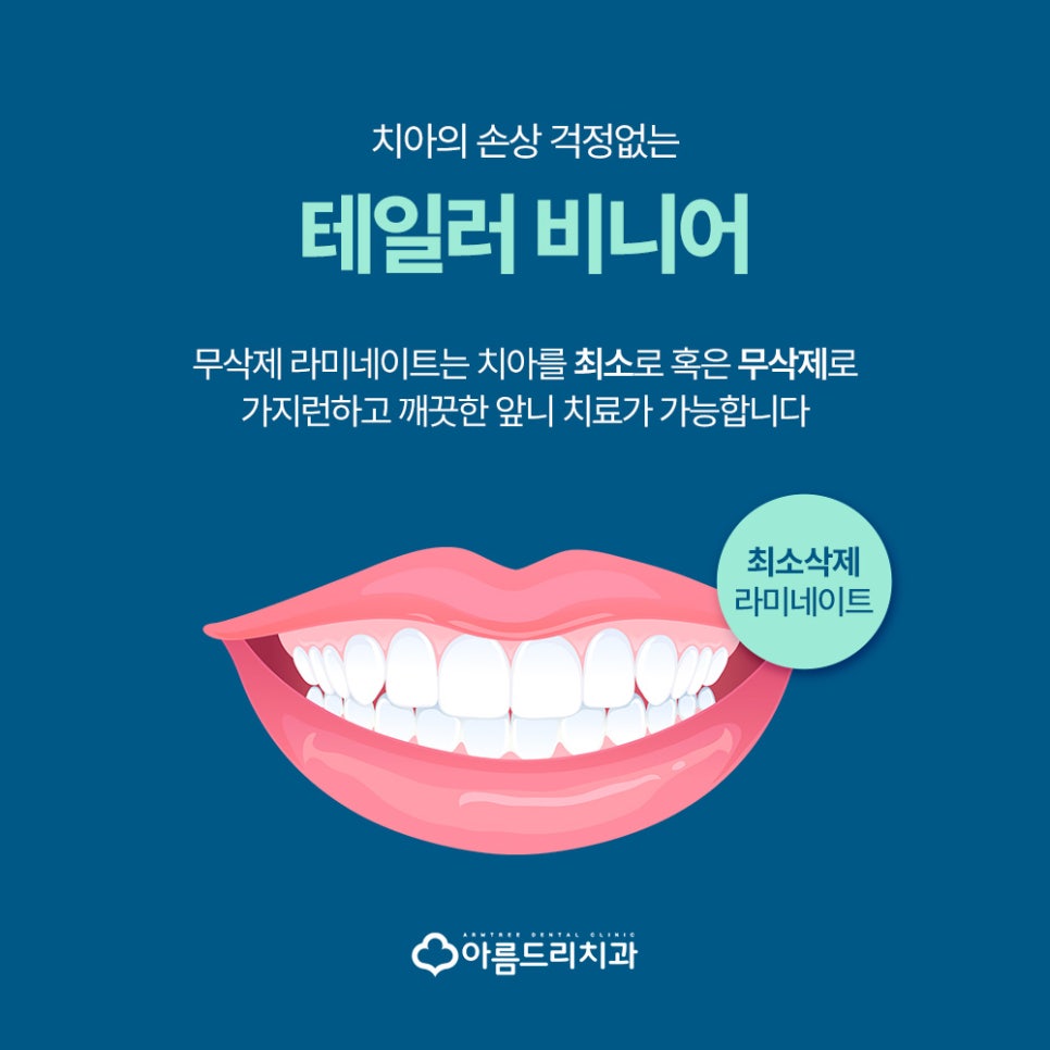 강남 무삭제라미네이트 A에서 Z까지 <테일러비니어> 관련 이미지 1