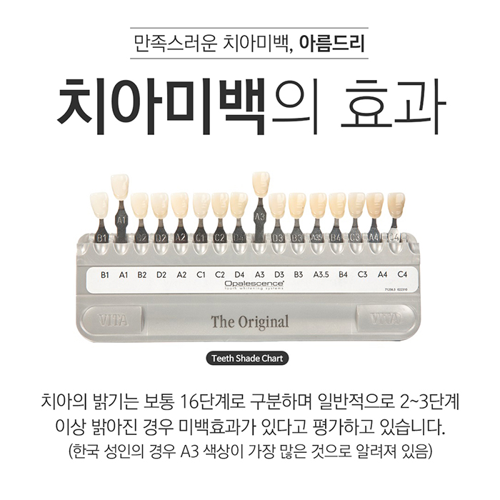 이빨미백 치과치아미백 결과의 차이 관련 이미지 6