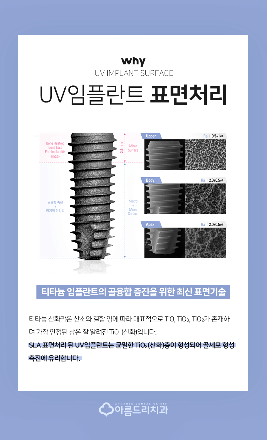 UV임플란트 부작용 걱정없이 아름드리치과 관련 이미지 3