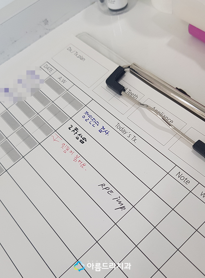 어린이치아교정 부정교합 RPE(급속구개확장장치) 악궁확장장치 관련 이미지 4