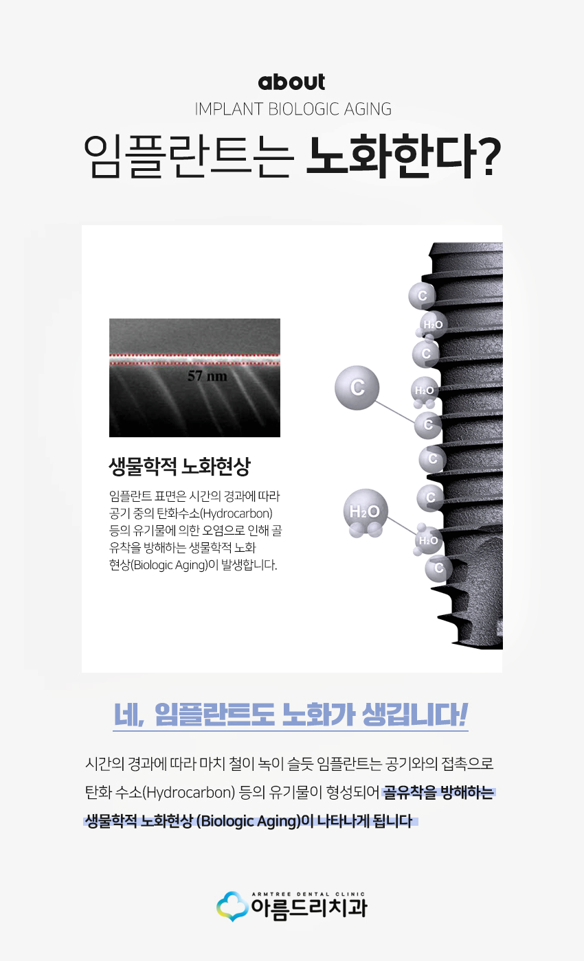 UV임플란트 부작용 걱정없이 아름드리치과 관련 이미지 2
