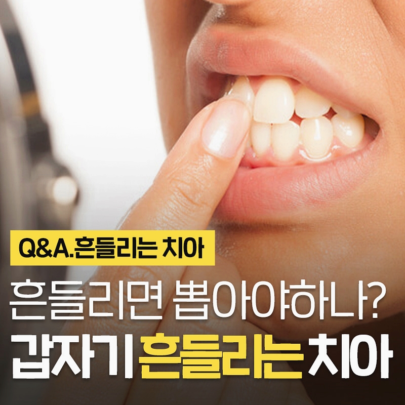 갑자기 흔들리는 치아 어떻게? 치주인대 아름드리치과 이현정의물음표 관련 이미지 1