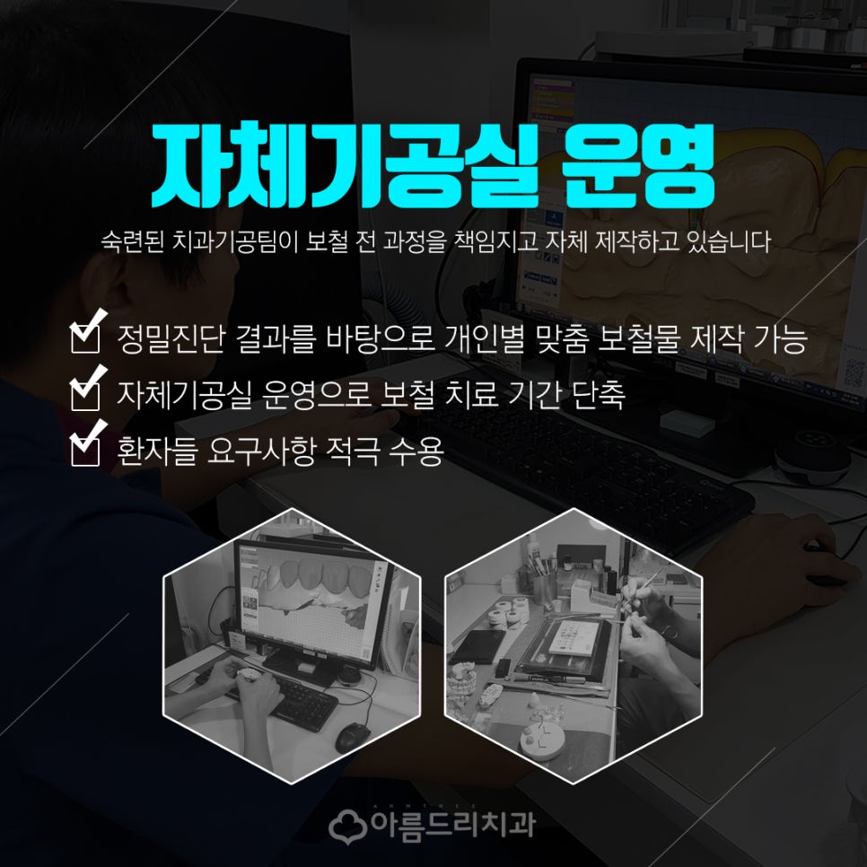 충치인레이 아말감주변 충치치료는? 관련 이미지 11