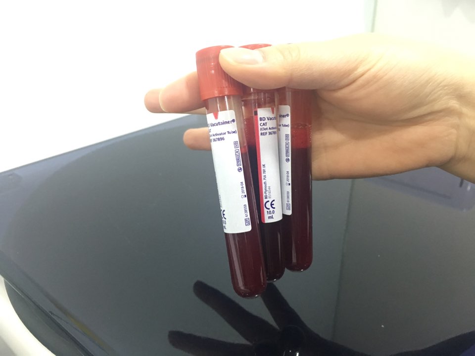 신논현역치과 PRF 자가혈 임플란트. 안전한 임플란트_아름드리 치과 관련 이미지 4