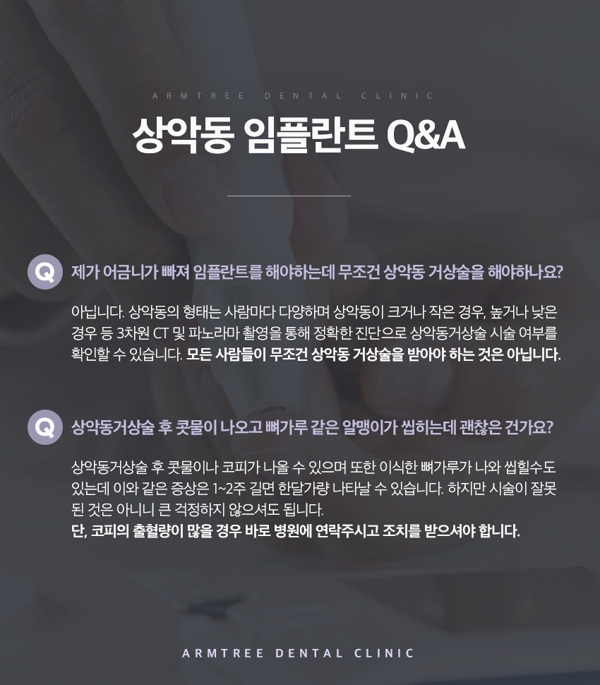 상악동거상술 통증이 걱정된다면 관련 이미지 8