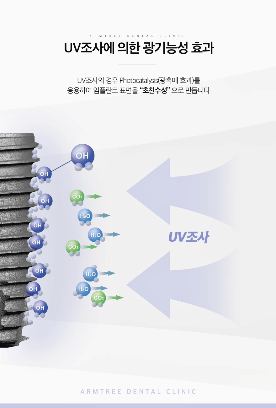 신논현 앞니임플란트 심미성이 중요하다면 관련 이미지 5