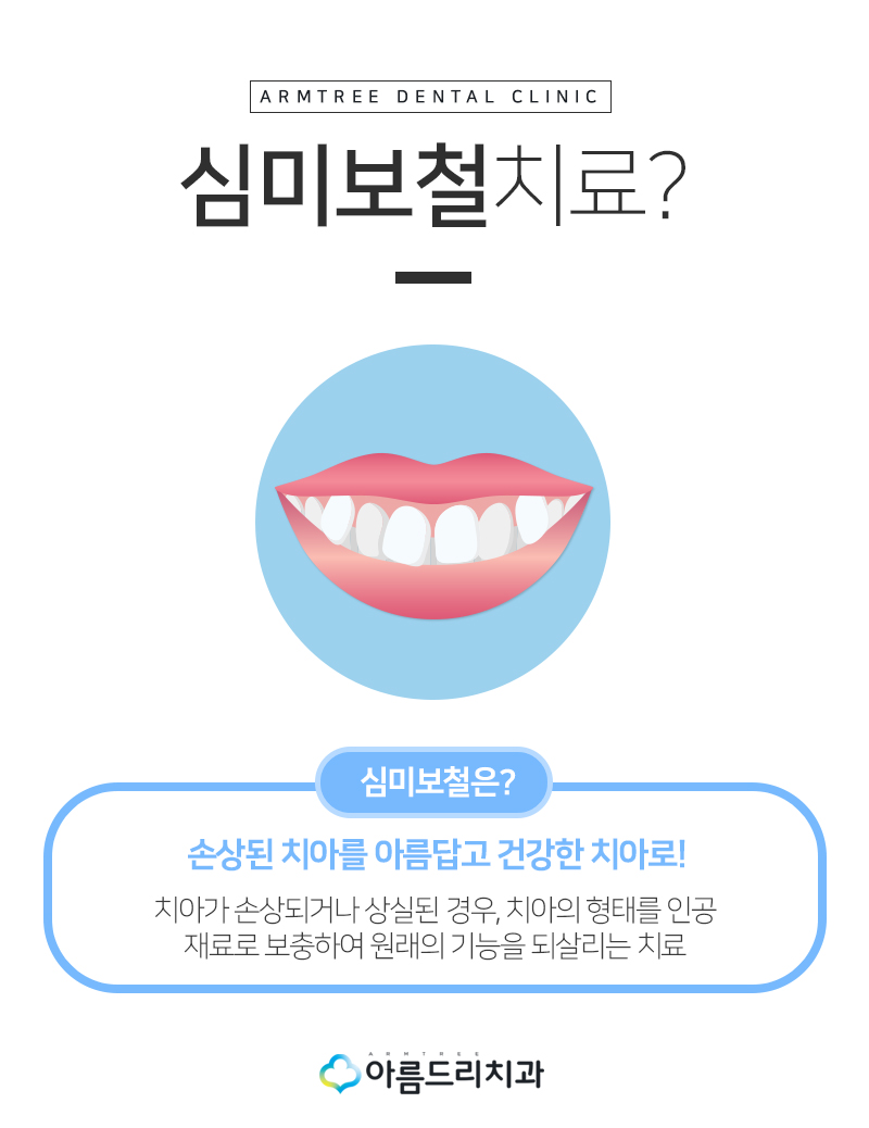 치아보철치료 앞니보철 후기 과연 관련 이미지 5