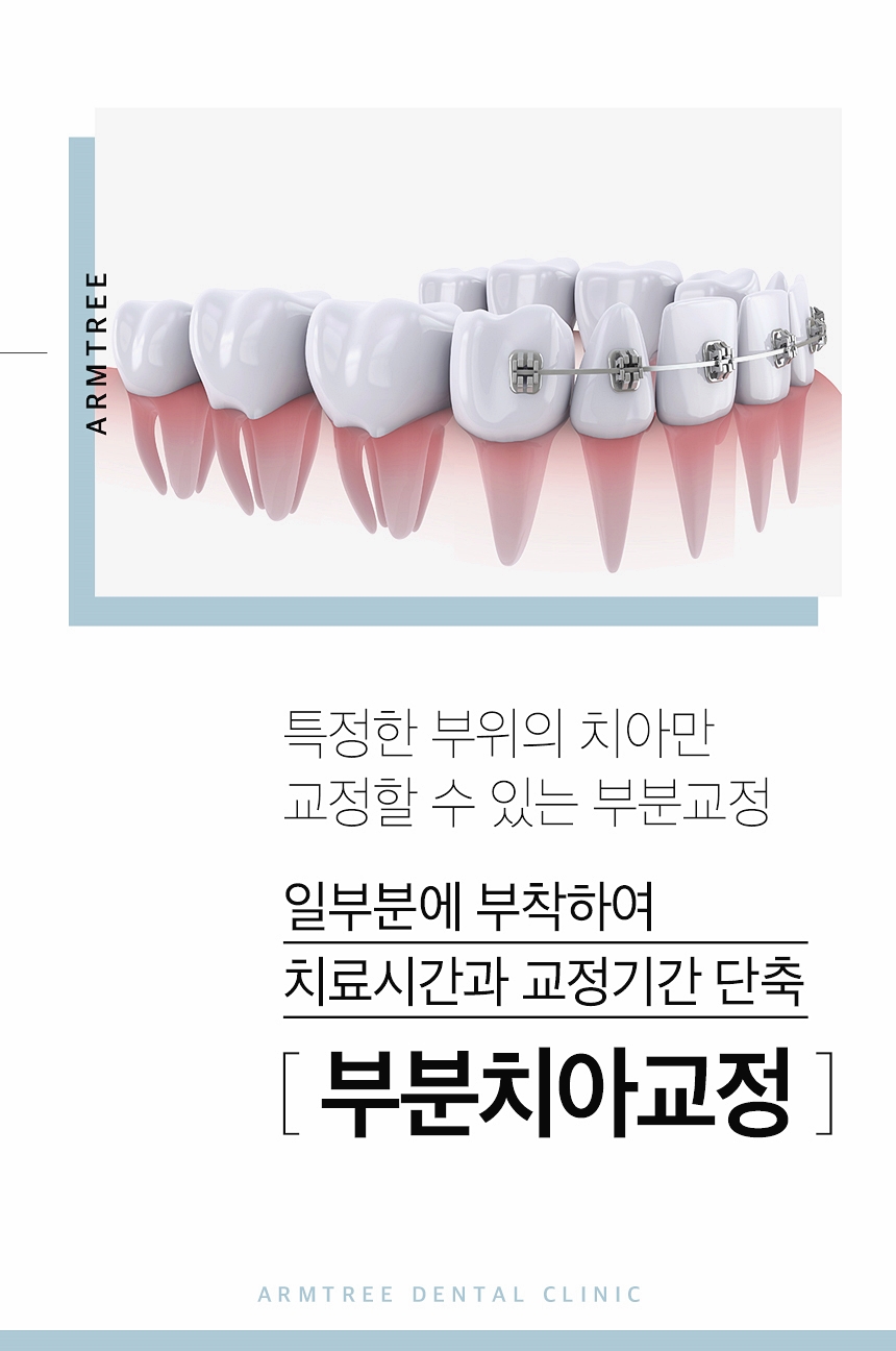 치아교정종류 신뢰가는 신논현역치과 관련 이미지 2