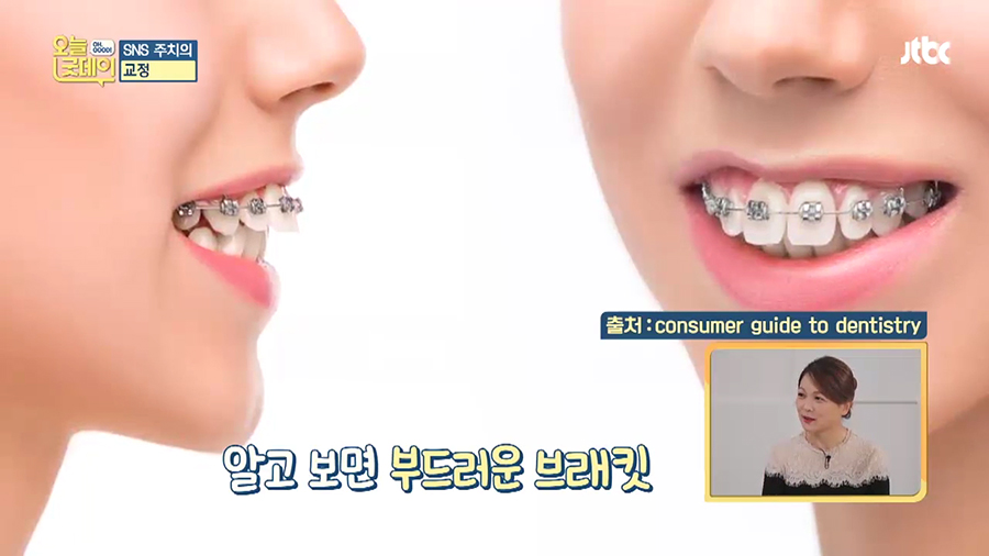 JTBC 오늘 굿데이 치아미백 아름드리치과 이현정원장 관련 이미지 21