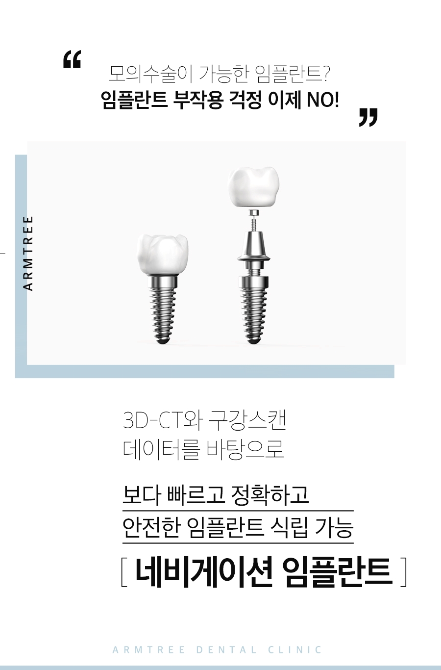 임플란트종류 오래쓰는 선택은 관련 이미지 2