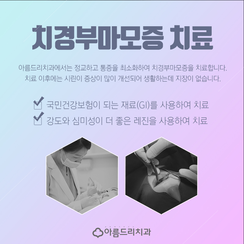 시린이 이시림치료 치경부마모증 관련 이미지 6