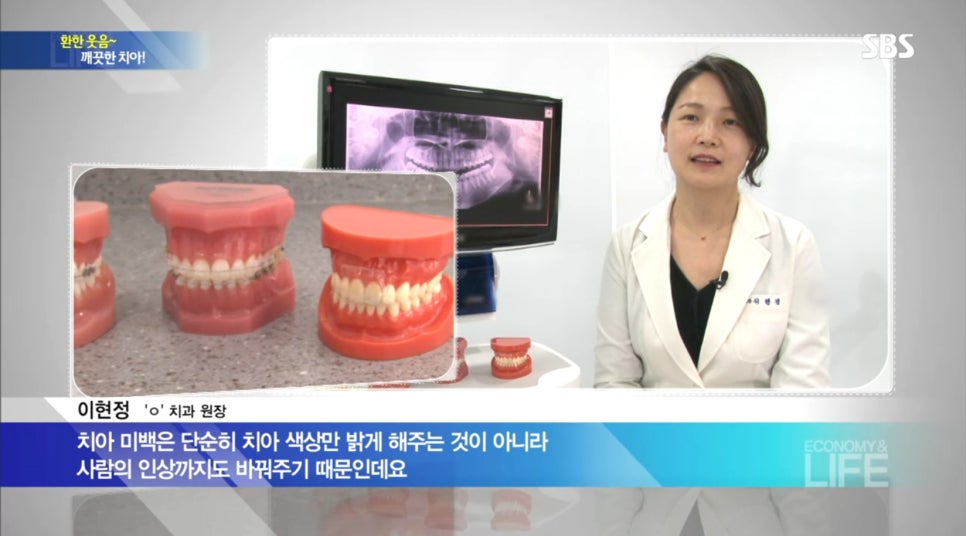 SBS 생활경제-이현정원장님 치아미백 인터뷰 관련 이미지 3