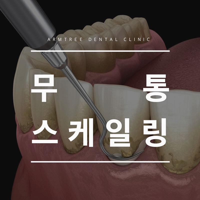 무통스케일링 안아픈치과 치과공포증 극복 아름드리치과 관련 이미지 1