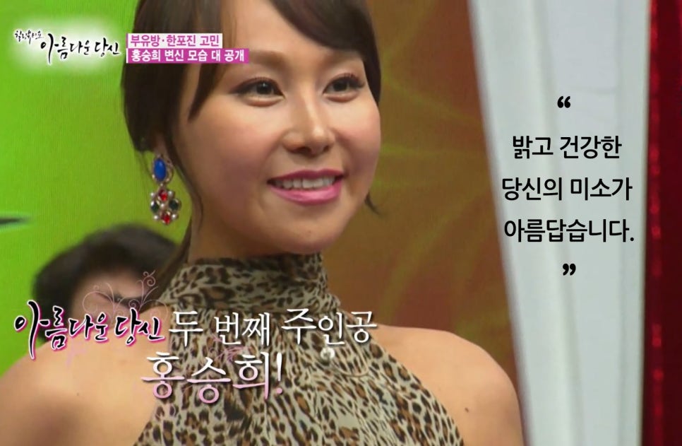 이현정 원장의 아름다운 당신 시즌 1 (9회 홍승희 도전자) 잇몸미백, 치아미백 관련 이미지 7