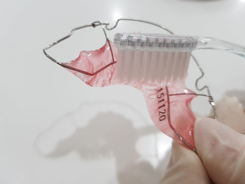 치아교정 후 유지 장치 세척&관리법 Tip_강남 아름드리 치과 관련 이미지 11