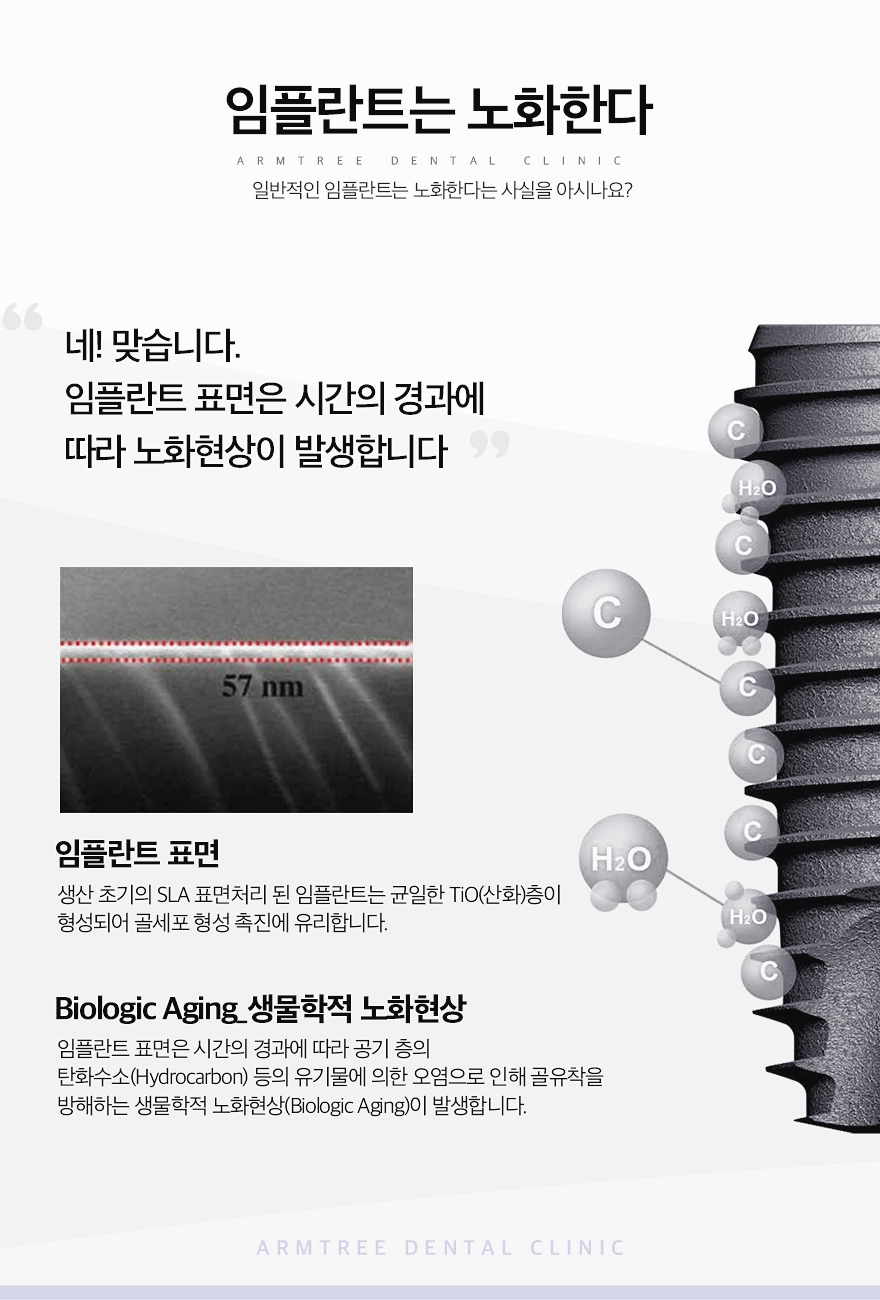 UV임플란트 꼼꼼히 따져보면 관련 이미지 4