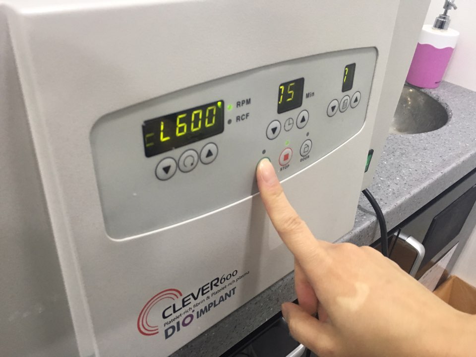 신논현역치과 PRF 자가혈 임플란트. 안전한 임플란트_아름드리 치과 관련 이미지 6