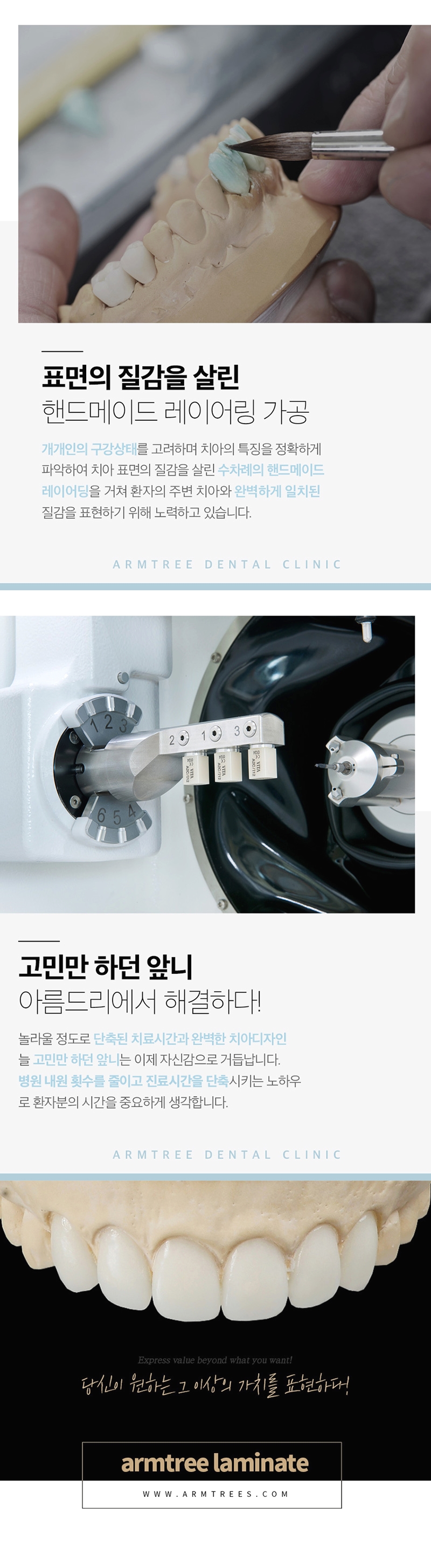 신논현라미네이트 심미성과 치아건강을 한번에 관련 이미지 3