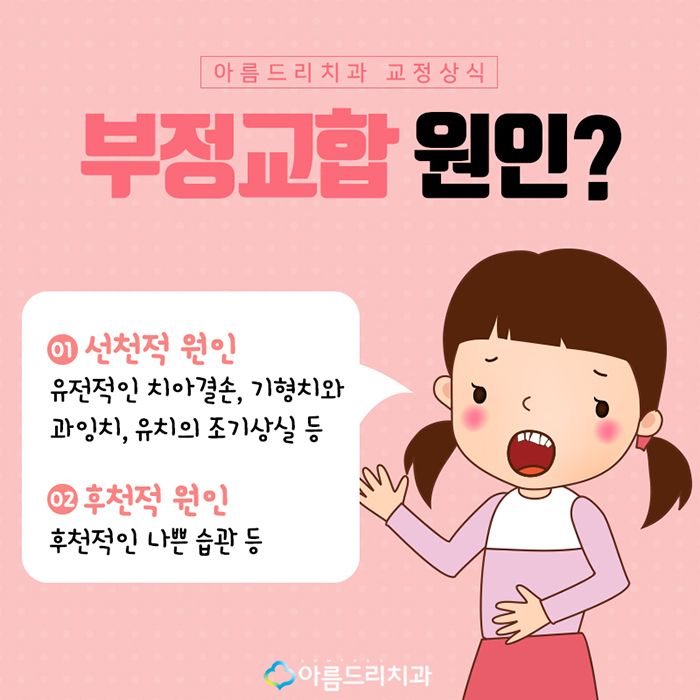 치아부정교합교정 원인과 예방법 관련 이미지 6